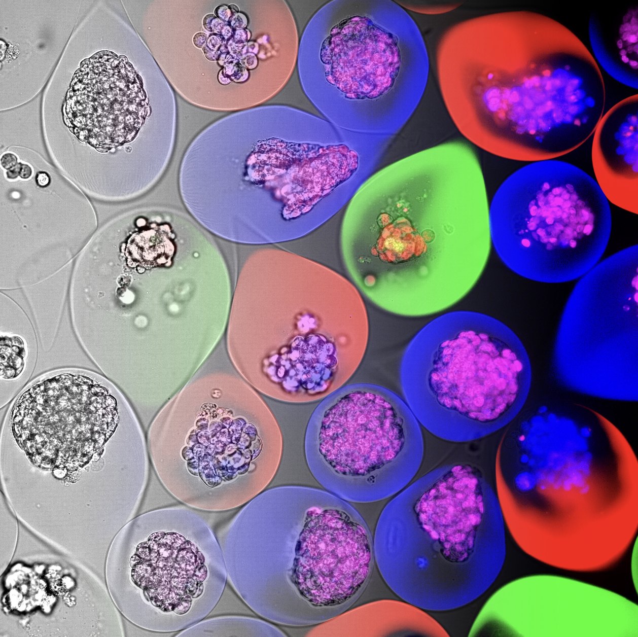 Micrograph of colour-coded encapsulated human spheroids of different tissue types cultured side by side in a single well.